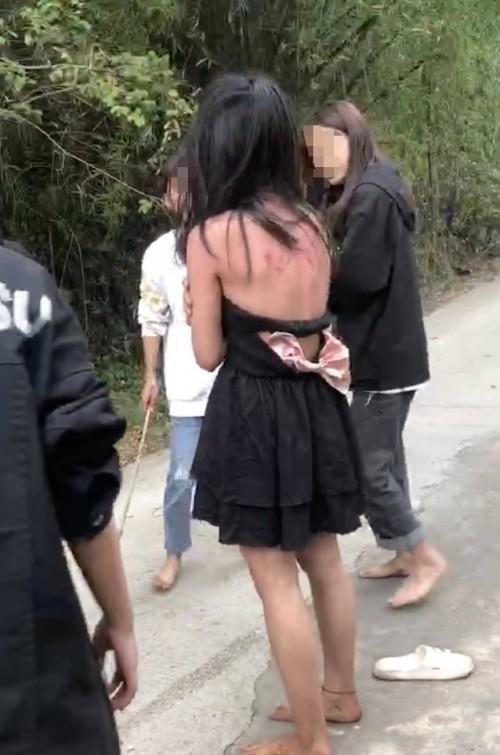 13岁女孩被霸凌耳膜鼓膜穿孔 打人者声称看其不顺眼