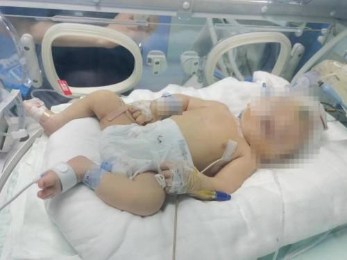 婴儿出生便头颅骨折 医院：正在处理中